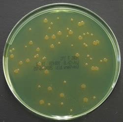 Tergitol Lactose Ttc Agar