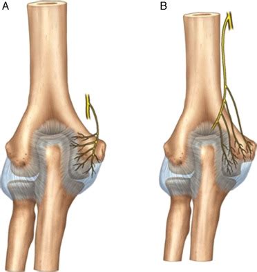 Ulnar Groove