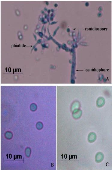 Morphological Characterization Of T Viride A Mycelia Bearing