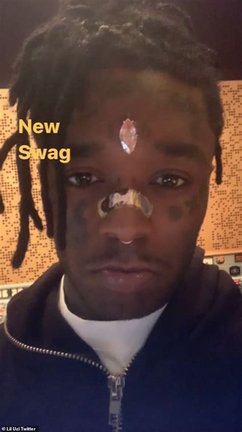 Rapper Lil Uzi Vert Reveals Fans Ripped Off Diamond On His Forehead Big World News