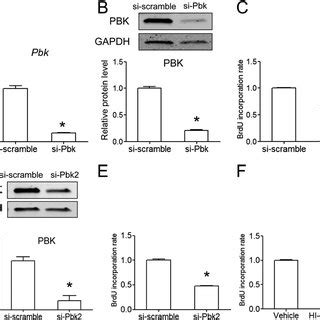 Pbk Knockdown Reduces Cell Proliferation In Mouse Insulinoma MIN6