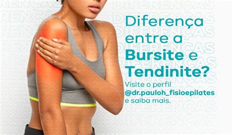 Blog Divulga Brejo Notícias Você sabe a diferença entre a Bursite e