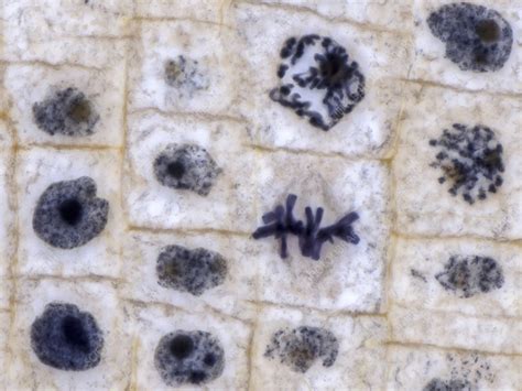 Onion Root Tip Mitosis Drawing At Larry Webb Blog