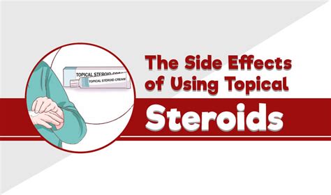 The Side Effects of Using Topical Steroids | Dynamic Nutrition