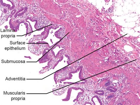 Gallbladder Histology Labeled