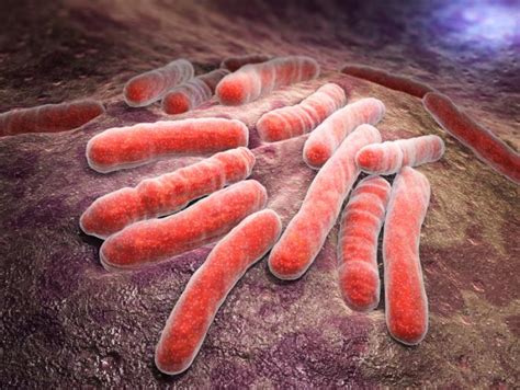 Is tuberculosis an autoimmune disease?