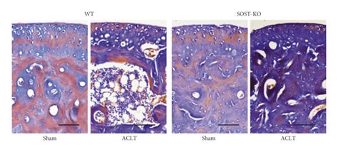 Sost Ko Mice Presented An Increase In Activation Of Osteogenesis And A