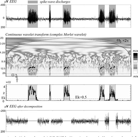 Figure From Sleep Spindles And Spikewave Discharges In Eeg Their