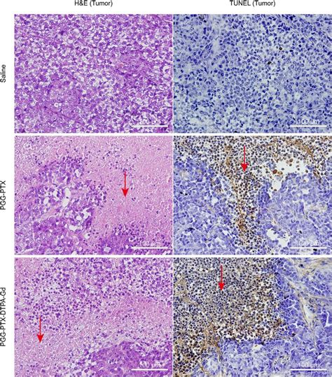 The H E Staining And TUNEL Assay For Tumor Tissues Harvested From The