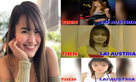 Lai Austria Old Photos Before Supposed Surgery Resurface Netizens