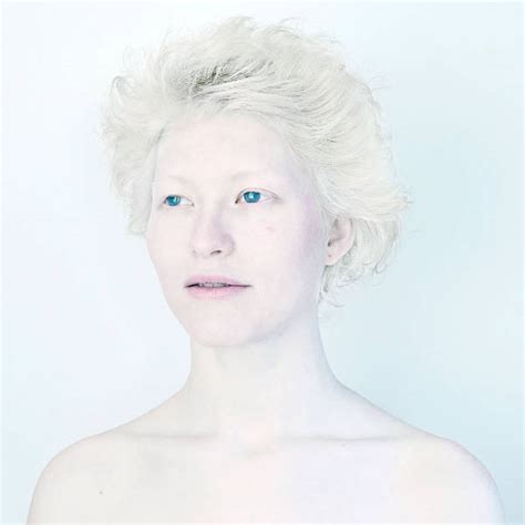 These Beautiful Albino People Are Simply Breathtaking 58 Pics