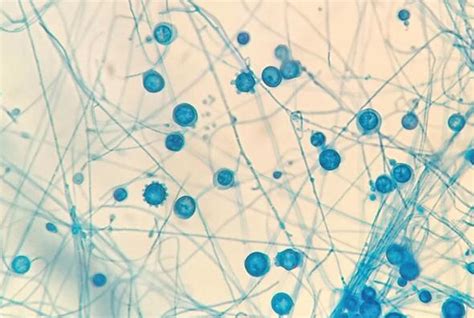 Histoplasma Capsulatum And Histoplasmosis Current Concept For The Diagnosis Intechopen