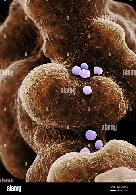 Mrsa Bacteria Coloured Scanning Electron Micrograph Sem Methicillin