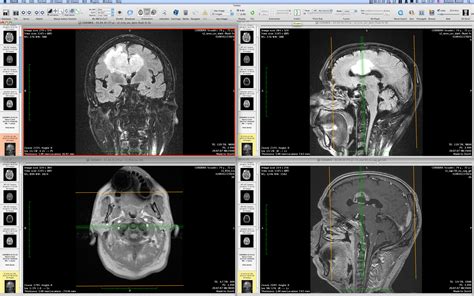 Fix Ferreterias Facturacion Electronica Osirix