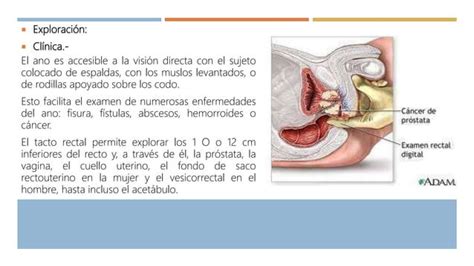 Recto Y Canal Anal Ppt