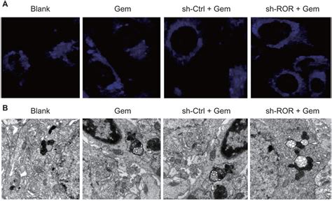 Linc Ror Influences Autophagosome Assembly In Gem Treated Mda Mb