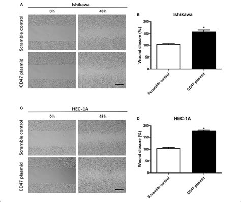 CD47 Up Regulation Promoted Migration In HEC 1A And Ishikawa Cells