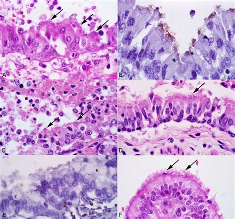 Frontiers Case Report: Bordetella Bronchiseptica, 55% OFF