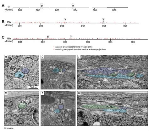 Supp Examples Of Electron Micrographs Of Dd Dorsal Neurite S