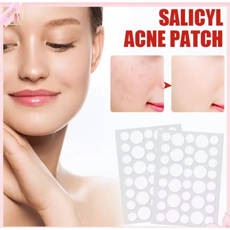 Jual Stiker Jerawat Acne Patch 1 Strip 36 Pcs Shopee Indonesia