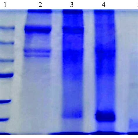 Sds Page Pattern Of Collagen From The Tuna Tail Tendon Marker