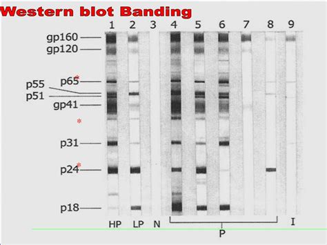 Ppt Hiv Testing Technologies Elisa Western Blot Powerpoint