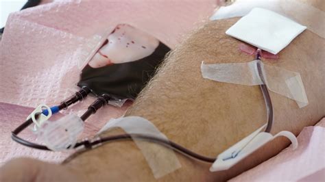 Fda Relaxes Blood Donation Guidelines For Gay And Bisexual Men Npr