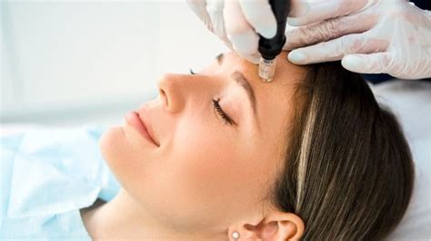 Dermapen Nedir Ne E Yarar Cilt Tedavisinde Dermapen Faydalar Ve