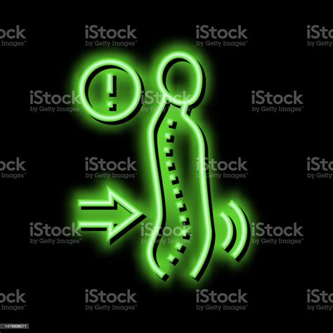 Lordosis Disease Neon Glow Icon Illustration Stock Illustration