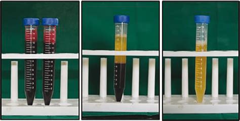 A Blood Sample Collected And Mixed With 32 Sodium Citrate