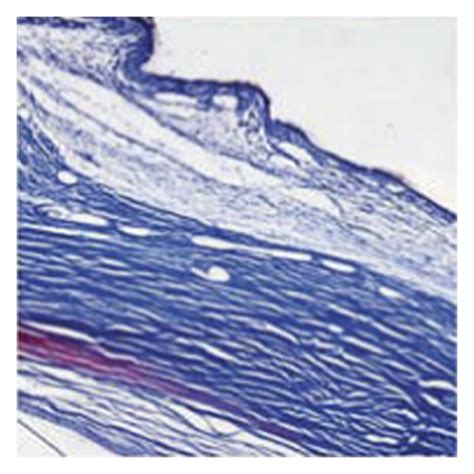 Histological Features Of Filtering Positions After Days