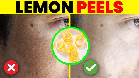 15 Amazing Uses And Benefits Of Lemon Peels You Didnt Know Youtube