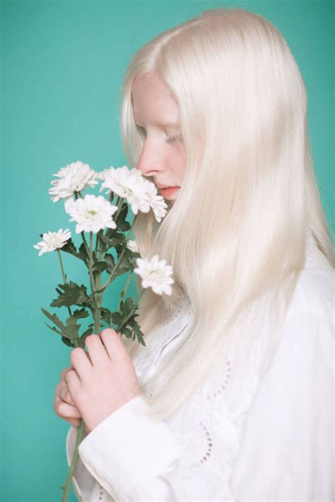 These Beautiful Albino People Are Simply Breathtaking 58 Pics