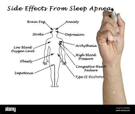 Side Effects From Sleep Apnea Stock Photo - Alamy