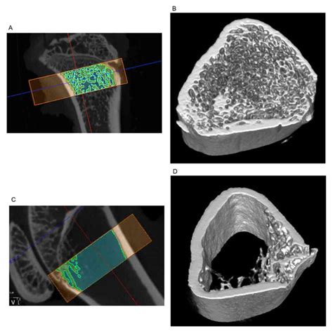 Enhanced Osseointegration Of Titanium Implants In A Rat Model Of Osteoporosis Using Multilayer