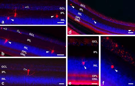 Retrogradely Labeled Retinal Ganglion Cells Rgcs Black Arrow Heads