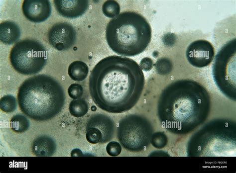 Yeast Fungi Slide