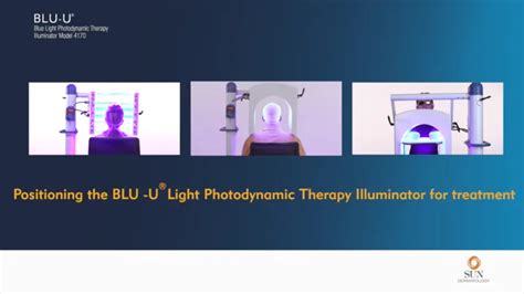 Blu U Blue Light Photodynamic Therapy Illuminator Model 4170 Shelly