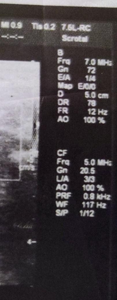 Scrotal Ultrasound To Rule Out Something Or Other R Xrayporn