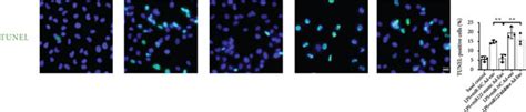 Adipocyte Derived Exosomal Mirna 122 5p Reinforces The Pulmonary