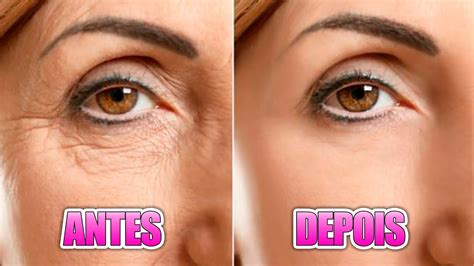 Mel No Rosto Rejuvenesce - Esfoliante Caseiro Para O Rosto Com Mel, Creme Para Rejuvenescer O ...