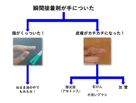 セメダイン On Twitter ω・´ ｡o （瞬間接着剤あるある、「手についた時」の対象方をフローチャートぽくしました。指が