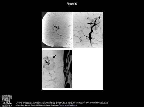 Feasibility Of Magnetic Resonance Imaging Guided Focused Ultrasound