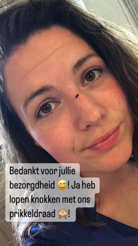 Foto Boerin Annemiek Koekoek Loopt Verwonding Op Na Knokpartij