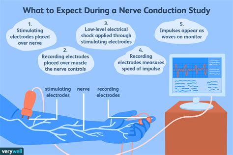 Understanding NCS and EMG Test Results