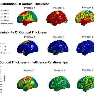 A Pearson S Correlations Among Cortical Thickness CT Cortical