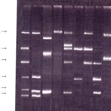 Plasmid Profile P1 P9 Of Representative E Coli Strains Isolated From