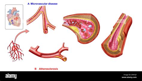 Blood vessel diagram hi-res stock photography and images - Alamy