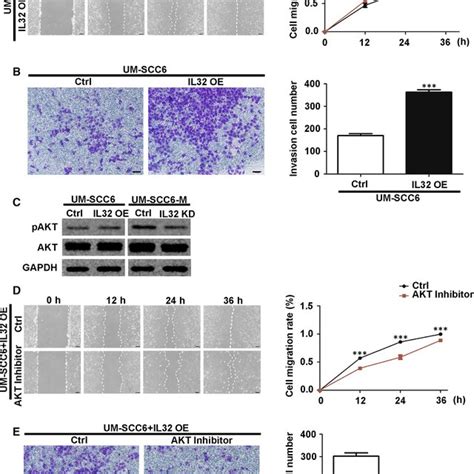 Il32 Promoted Oscc Cell Migration And Invasion By Activating Akt