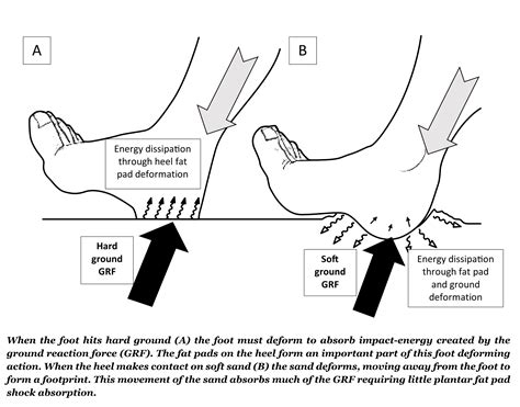 Fat Pad Atrophy Insoles And Orthotics Healthy Step